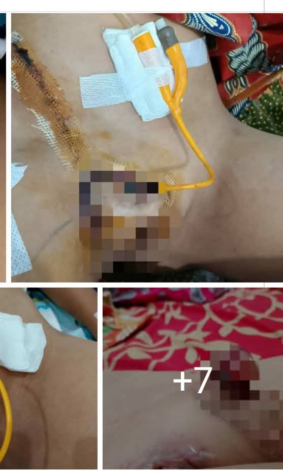 Geger…! Bocah di Kayu Aro Alami Putus Kelamin Usai Sunat Laser