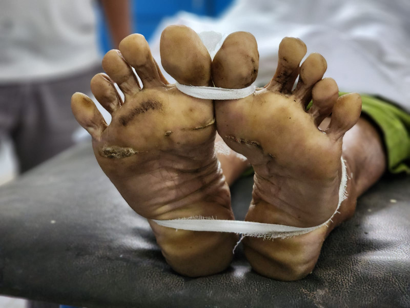 Dodos TBS Tersengat Arus Listrik, Karyawan PT Salim Group Meninggal Dunia